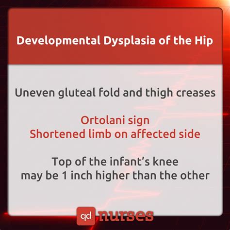 Ortolani sign is what you need to look out for with developmental ...