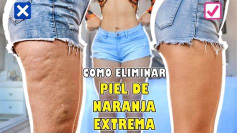 Mi T Cnica Para Eliminar Celulitis Extrema A Prueba De Todo Youtube