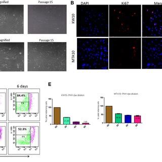 Establishment And Phenotypic Characterization Of Primary Glioblastoma