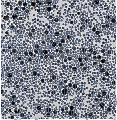 Particle Size Determination Of All The Particles That Can Be Observed