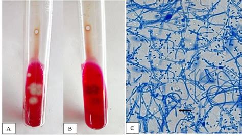 Trichophyton rubrum. (A): Growth on DTM (obverse). (B): Growth on DTM... | Download Scientific ...