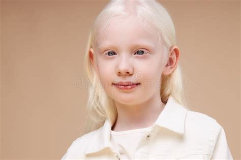 Portrait of Smiling Albino Child Isolated Stock Image - Image of camera ...