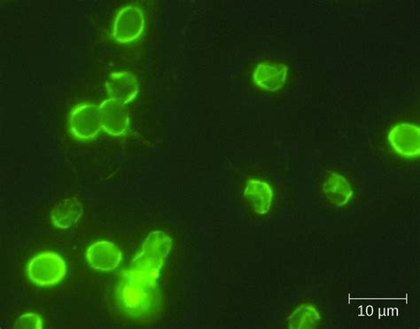 protozoan infections   gastrointestinal tract microbiology