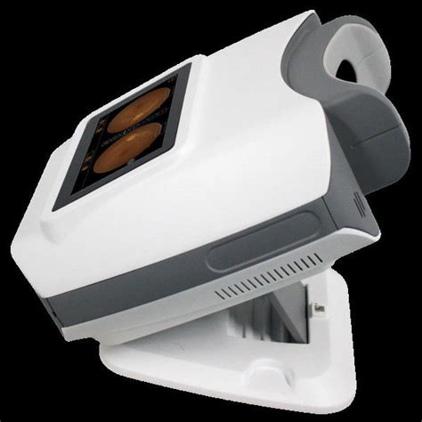 Portable Non Mydriatic Fundus Camera Kestrel 300