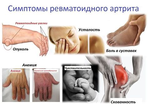 Боль в суставах и костях – причины и лечение. Что помогает? | Aurafix ...