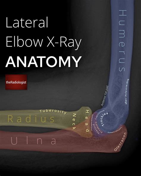 Theradiologist On Twitter Upper Limb Anatomy