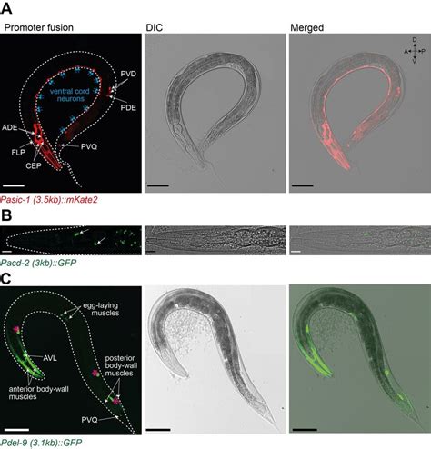 Acid Activated Deg Enacs Are Expressed In Neuronal And Non Neuronal