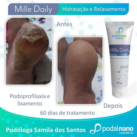 Creme Hidratante Probióticos Podal Nano Cosméticos