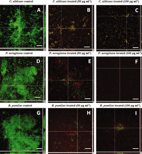 Clsm Analysis Of Preformed Biofilms Of C Albicans A B C P Download Scientific Diagram