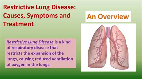 restrictive lung disease causes Restrictive lung diseases - Diseases ...