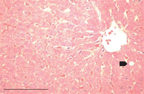 Photomicrographs Of The Liver Stained With Hematoxylin And Eosin He