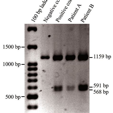 Polymerase Chain Reaction And Restriction Fragment Length Polymorphism