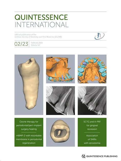 Clinical Efficacy Of Subepithelial Connective Tissue Graft And A PRF In