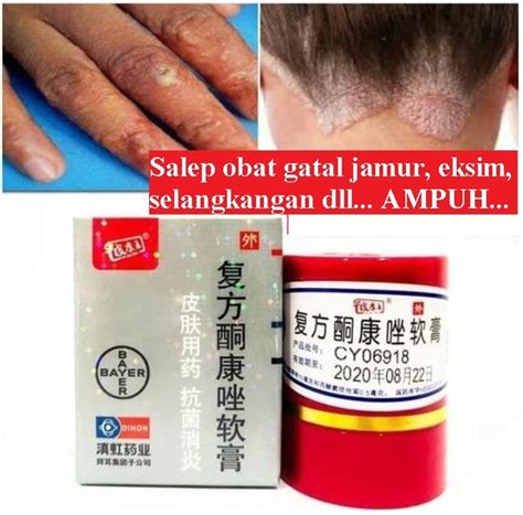 Jual Salep Pi Kang Wang Obat Gatal Eksim Panu Dan Penyakit Kulit Lain