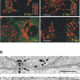 Drp1 Translocates To The Mitochondria During Apoptosis A In Healthy