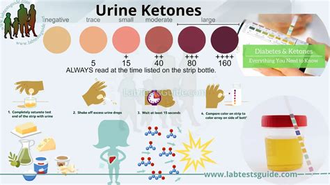 Urine Ketones: Definition, Causes, Symptoms, Diagnosis, and Treatment