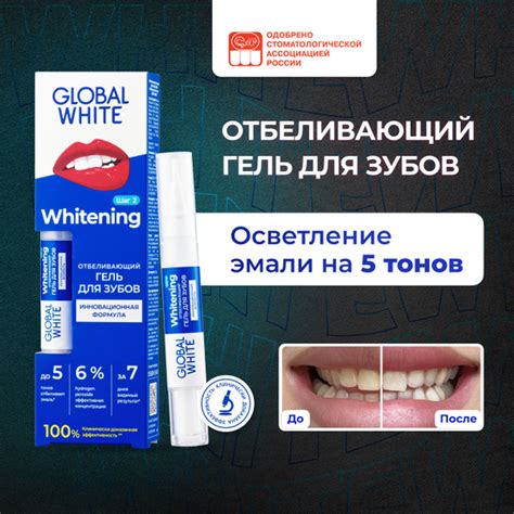 Global White Отбеливающий карандаш для зубов / Отбеливание зубов ...