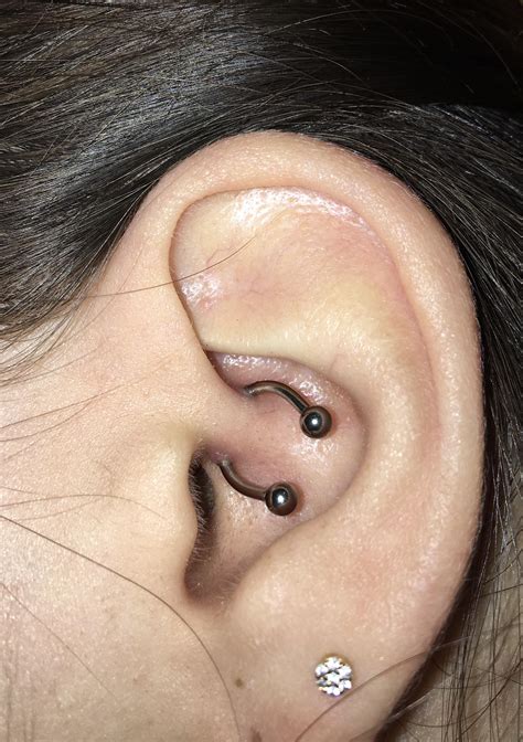 Hi All 1 Month Old Daith Piercing Is The Lower Bump A Keloid I Ask