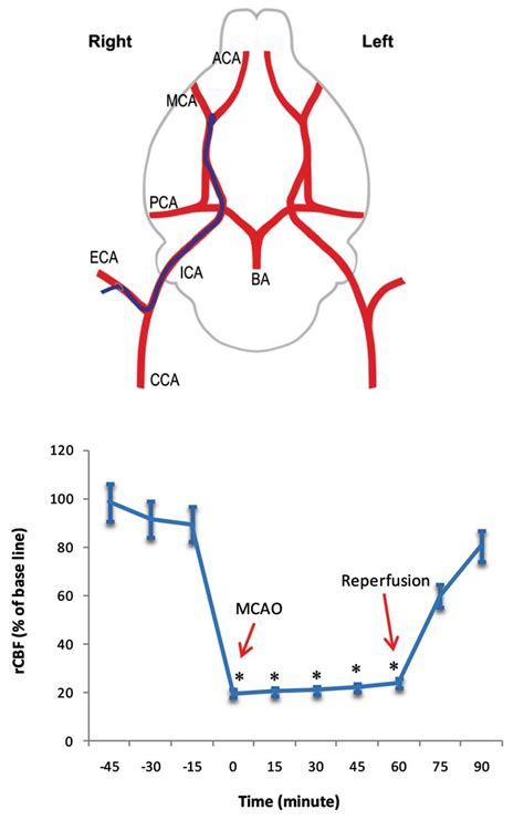 Middle Cerebral Artery Occlusion And Evaluation Of The Regional