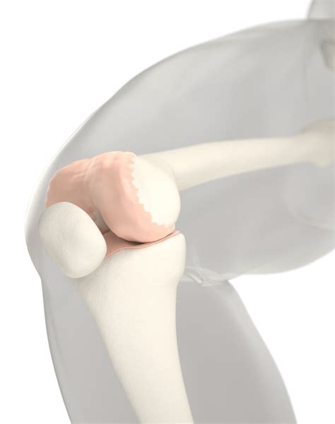 Knee Cartilage - What Is Cartilage? - Episurf Medical