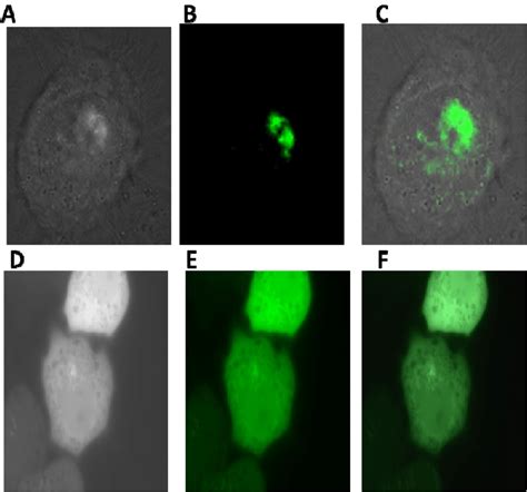 Localization Of Φd145 Int Gfp Fusion Protein In Hela Cells A C Hela