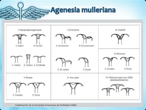 Amenorrea Primaria Y Secundaria Ppt