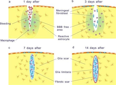 Schematic Drawings Represent The Process Of The Lesion Scar Formation