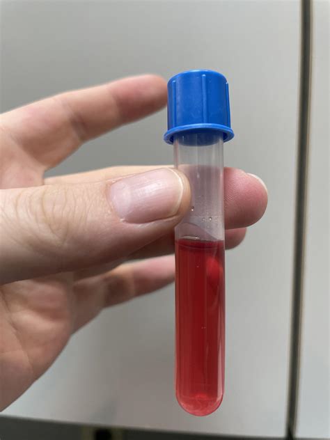 More blood than urine... surprisingly no stones. : r/VetTech