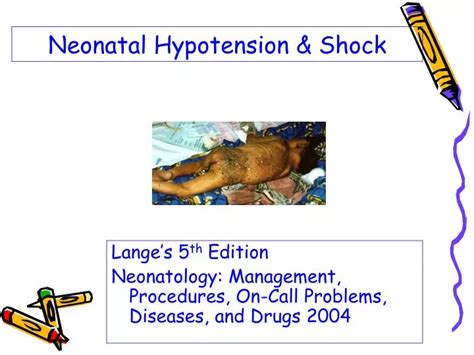 Ppt Neonatal Hypotension And Shock Powerpoint Presentation Free