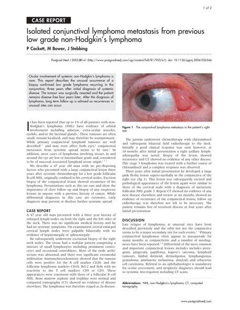 Pdf Isolated Conjunctival Lymphoma Metastasis From Previous Low Grade Non Hodgkins Lymphoma