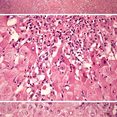 Photomicrographs Of Liver Biopsy In Hematoxylin And Eosin Staining Download Scientific Diagram