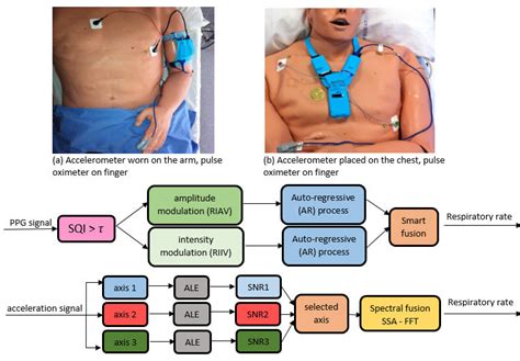 The Wearable Sensors Including Ecg Ppg And Accelerometers Are Shown