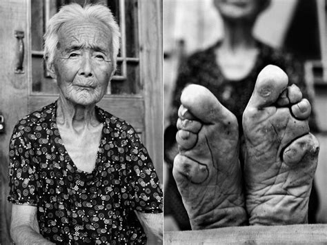 Outlawed Foot Binding Practice In China Sesame Disk Group