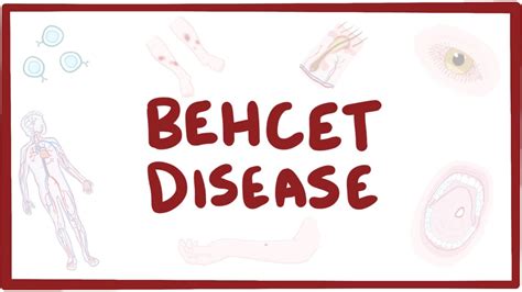 Behcet's disease: Video, Causes, & Meaning | Osmosis