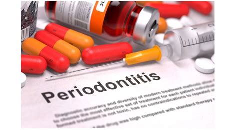 Qual O Melhor Antibiótico Para Periodontite - Comparación de antibióticos sistémicos de 3 y 7 días complementarios a ...