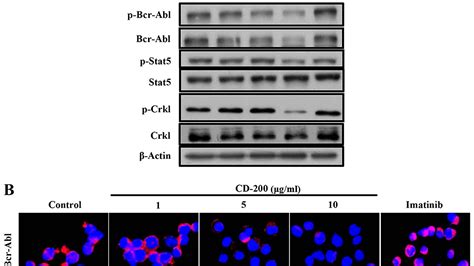 Imatinib - Imatinib Side Effects - Effect Choices