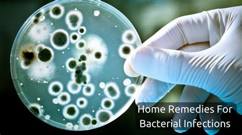 14 Best Natural Remedies to Treat Bacterial Infections