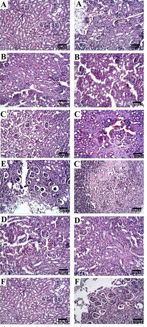 Photomicrograph Of Hematoxylin And Eosin Stained Kidney Slices From A