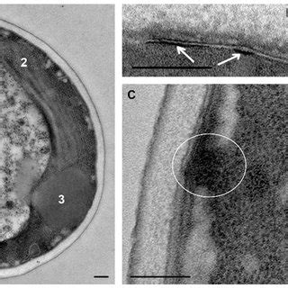 Changes In C Albicans Cell Ultrastructure After Min Incubation With