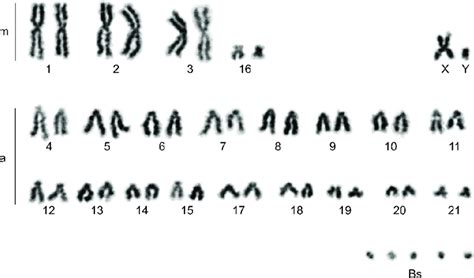 Conventionally Stained Karyotype Of N Leisleri Male With 5Bs 44 5Bs