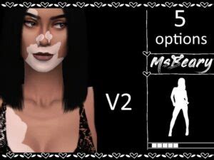 15+ Best Sims 4 Vitiligo Skin CC & Mods (Download) 2024