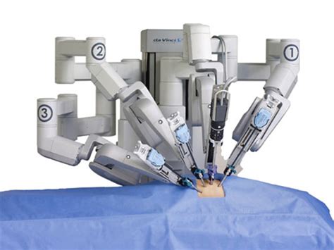 Robotic Surgery The Technology Benefits And Risks Hubpages