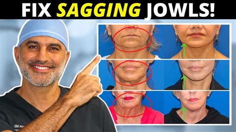 Sagging Jowls 101 How They Form And What To Do About Them Tighten