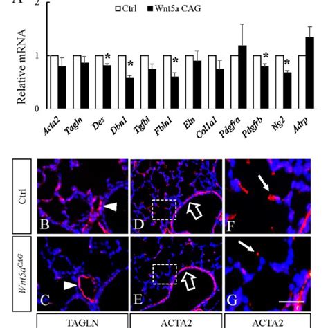 Postnatal Inactivation Of Wnt5a Decreases Expression Of Genes Enriched