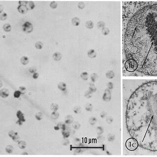 A light micrograph of isolated mitochondria (Fig. 1 a); thin-section ... 