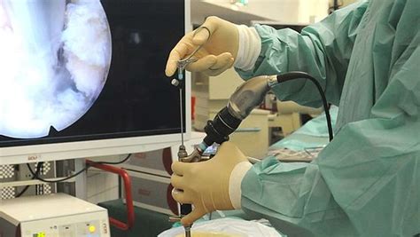 WHAT IS ENDOSCOPIC SURGERY? | Microspine PLC