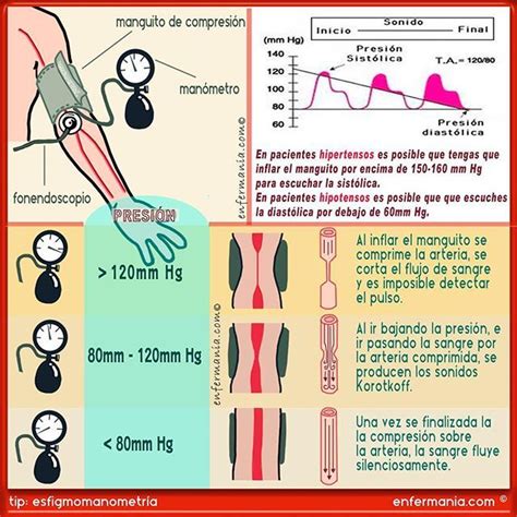 La presión arterial es la fuerza que la sangre ejerce sobre las paredes