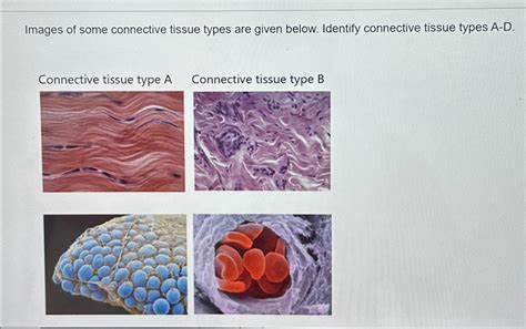 Solved Images of some connective tissue types are given | Chegg.com