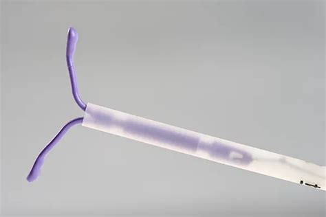 Identify Modifiers in This IUD Removal/Insertion Scenario : Reader Question