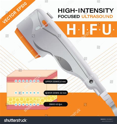 high intensity focused ultrasound for face 6